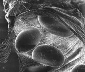 nosema 